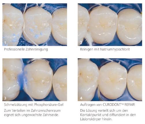 Zahn Erfindung aus der Schweiz